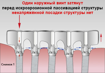 files/pages/Sheffield-Test/Sheffield_Test_1_R.jpg