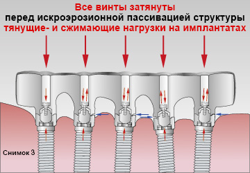 files/pages/Sheffield-Test/Sheffield_Test_2_R.jpg