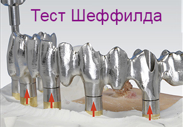 files/pages/Sheffield-Test/Sheffield_Test_4_R.jpg