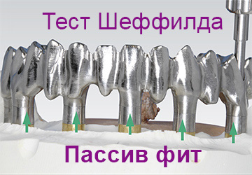 files/pages/Sheffield-Test/Sheffield_Test_5_R.jpg